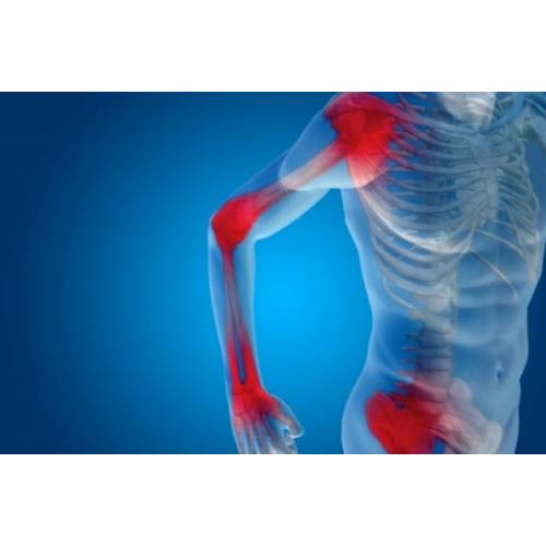 Osteoporoza si osteopenie - tratament naturist